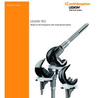 LEGION Universal Instruments Surgical Technique