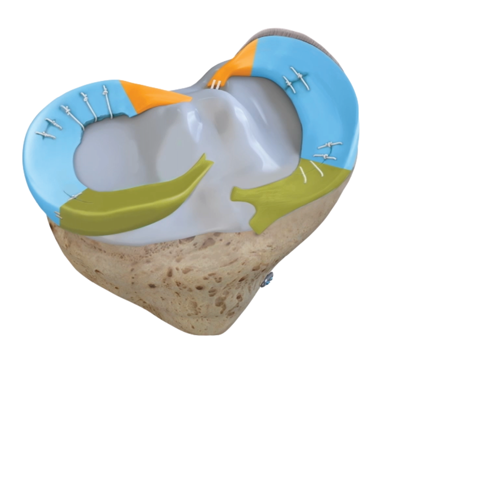 meniscus campaign_image