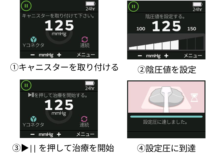 RENASYSEDGE Product feature1.png