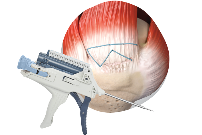 TENDON SEAM Hero Banner