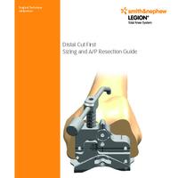 LEGION TKS Surgical Technique Addendum