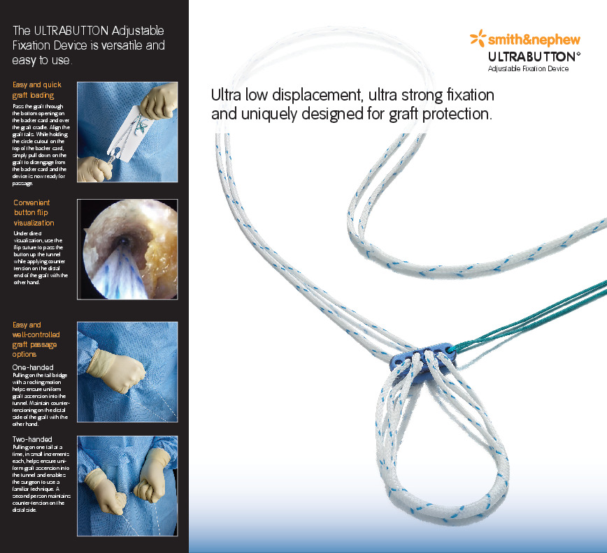 ULTRABUTTON Brochure