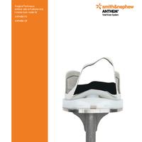 ANTHEM Total Knee System Anterior only or Posterior only Femoral Sizer Guide