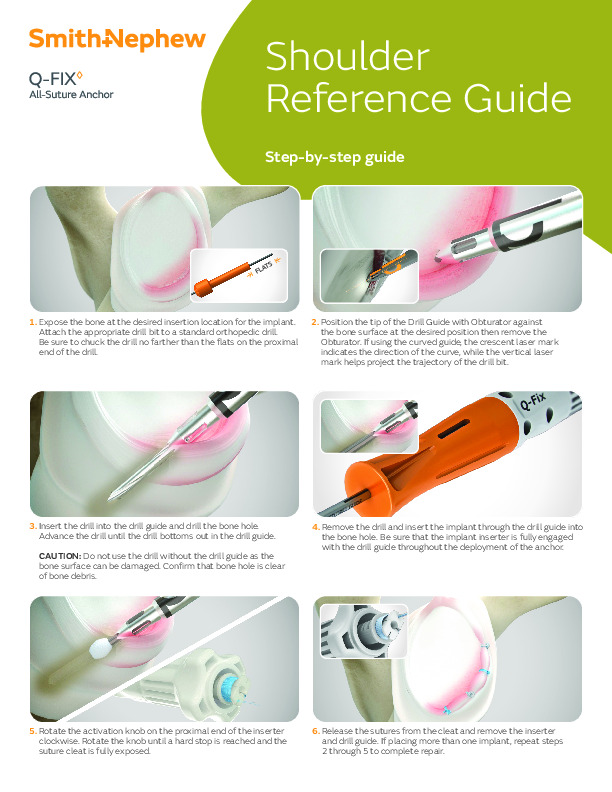 Q-FIX CURVED Reference Guide (Shoulder)