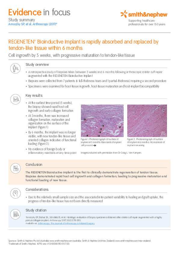 Evidence in Focus REGENETEN Arnoczky