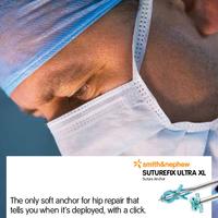 Suturefix Ultra XL Sales Sheet