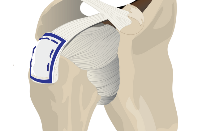 regeneten_illustration.psd