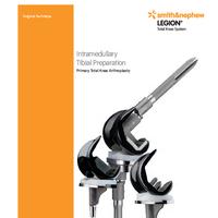 LEGION Tibial IM