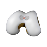 1-Trochlea-multi-implant.png