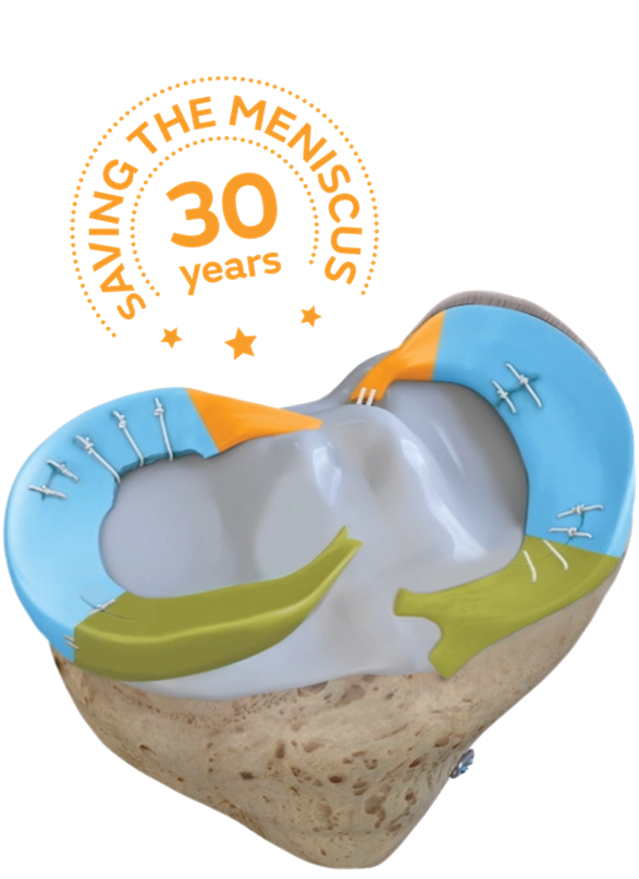 30 years meniscus.png