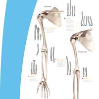EVOS SMALL - Plattensystem Obere Extremität Poster