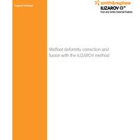 ILIZAROV Foot Ankle Mid-Foot Deformity Surgical Technique