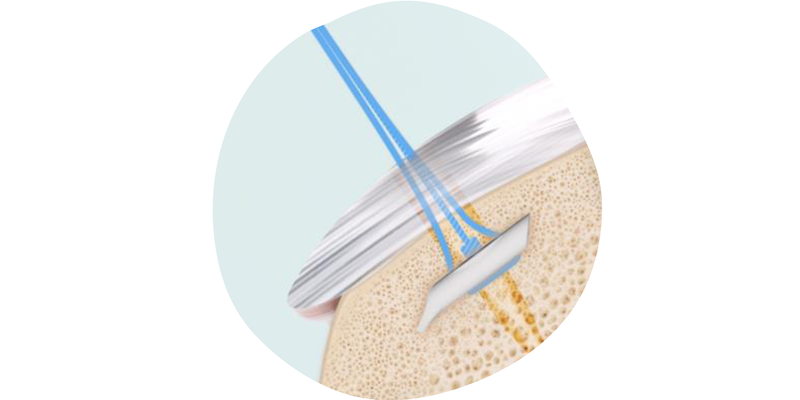 TENDON SEAM Flipbook 5 - Access to biology for healing