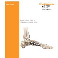 VLP FOOT Column Fusion Surgical Technique