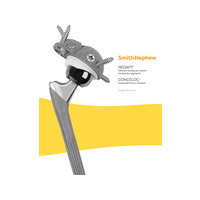 REDAPT Revision Acetabular Augment Design Rationale