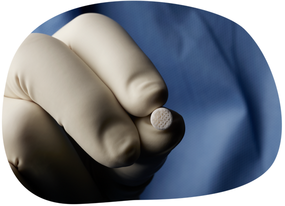 Surgeon-holding-CARTIHEAL-graphic overview.png