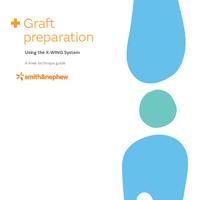 X-WING Graft Preparation System Technique Guide