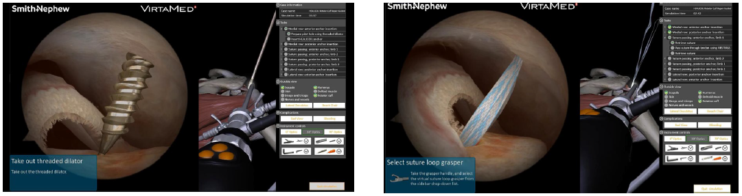 Surgical Screens.png