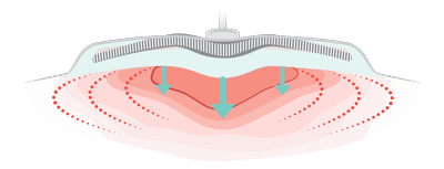 WOUND-PLUS_Below.png