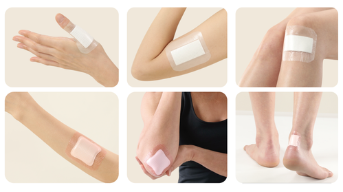 AWM_OPO and AGBL applications.png