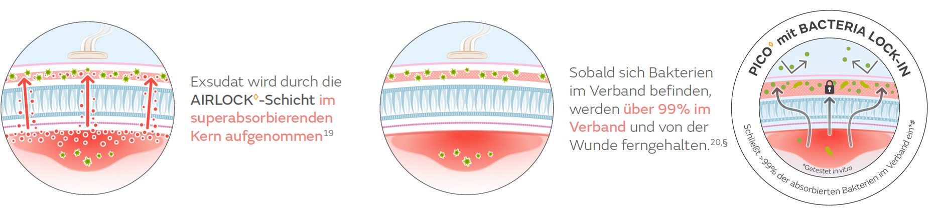 PICO Bacteria lock.png