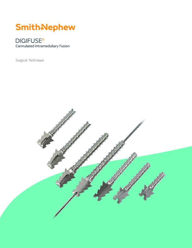 DigiFuse Surgical Technique