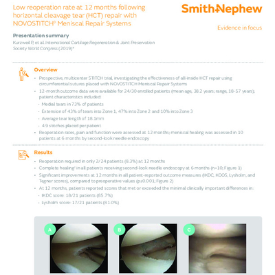 NOVOSTITCH Evidence in focus Kurzweil