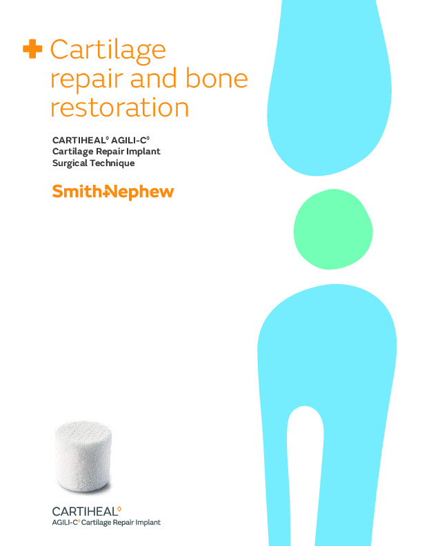CARTIHEAL AGILI-C Cartilage Repair Implant Surgical Technique