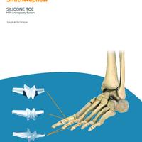 Silicone Toe System Surgical Technique