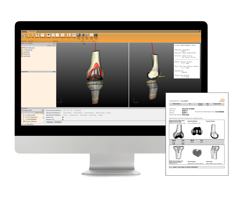 CORIOGRAPH Knee Main Body Image