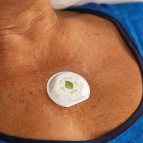  Seven million hours of patient data shows that Smith+Nephew’s wireless, wearable LEAF◊ Patient Monitoring System helps prevent hospital-acquired pressure injuries