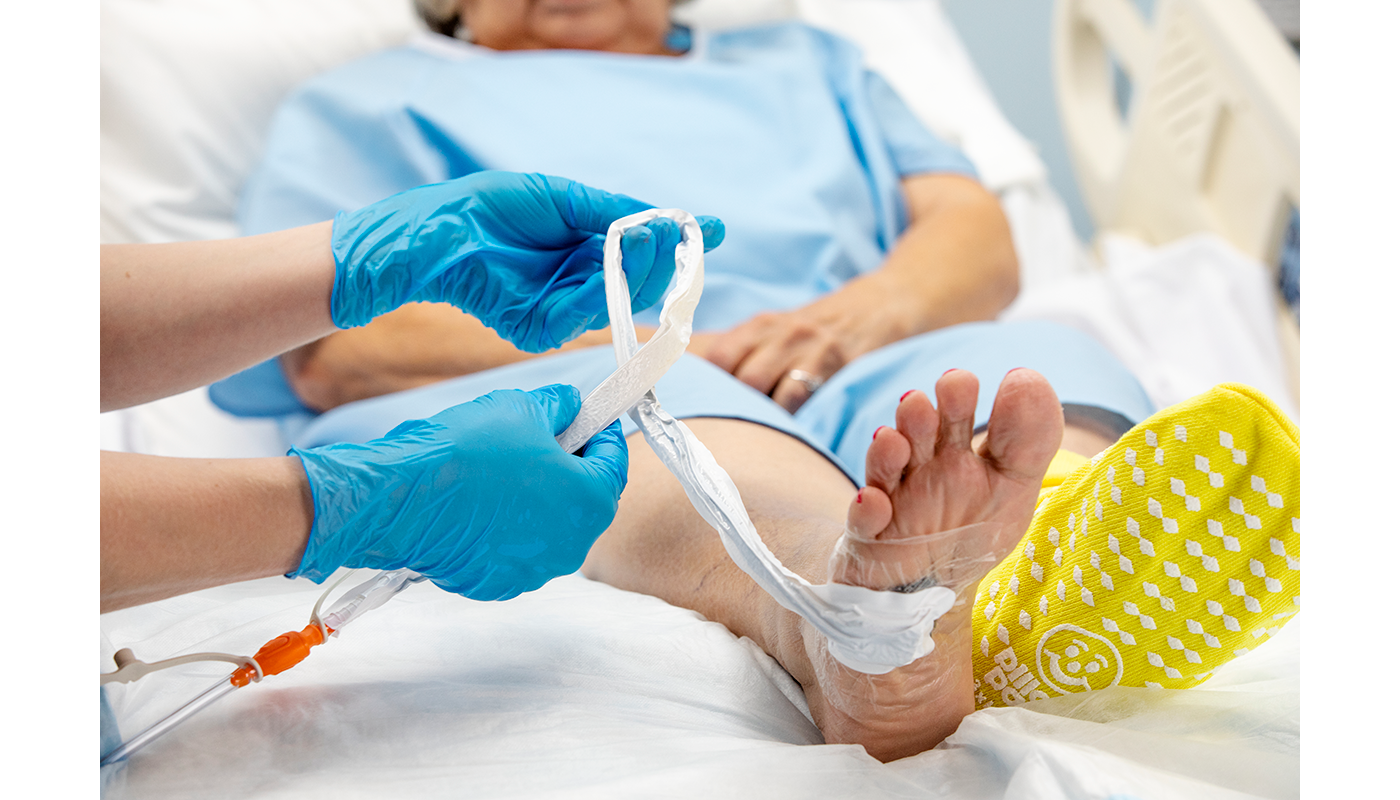 RENASYS Soft Port on foot