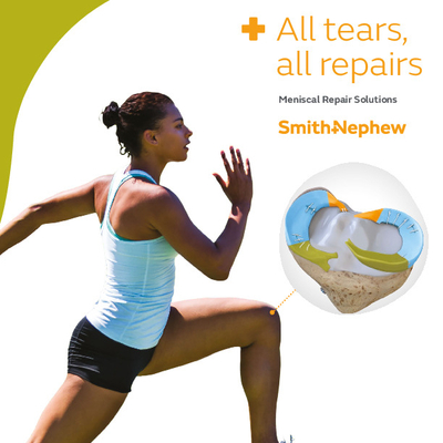 All Tears, All Repairs Meniscal Repair Solutions brochure