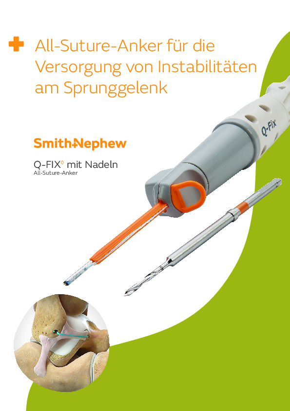 Small Joint - Q-FIX mit Nadeln - Bestellinfo - 40740-de