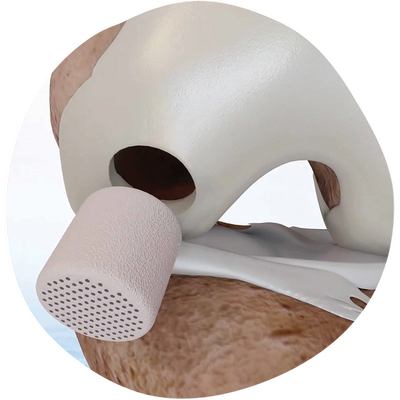 cartiheal_cutout_small.psd