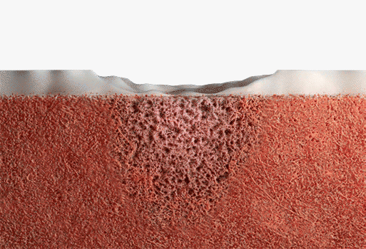 CARTIHEAL AGILI-C MOA GIF