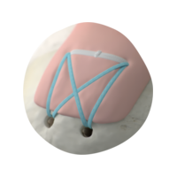 FullThicknessTear_HeroCutout(40062)_20250211