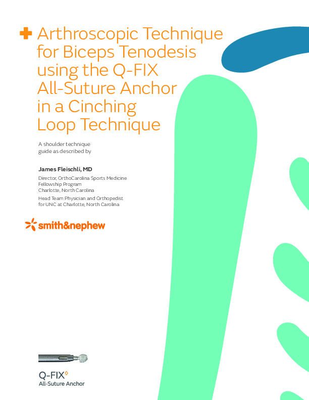 Arthroscopic Technique for Biceps Tenodesis using the Q-FIX All-Suture Anchor in a Cinching Loop Technique