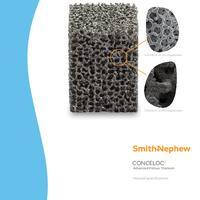 CONCELOC Material Data Sheet (Global/US)