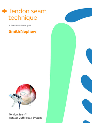 TENDON SEAM technique guide