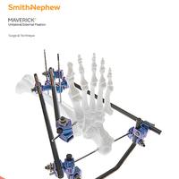 MAVERICK Surgical Technique