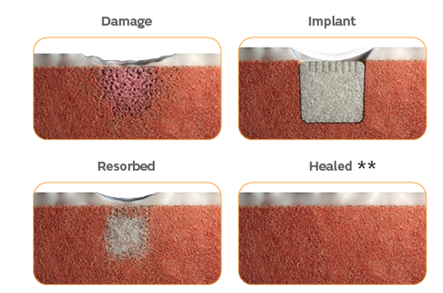 41813-V1-KNE-CARTIHEAL-AGILI-C-webpage-hero-seconary-images-06245_combo.psd