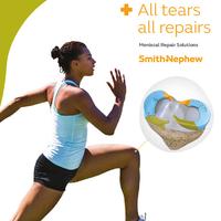 All Tears All Repairs Meniscal Portfolio (04425-en)
