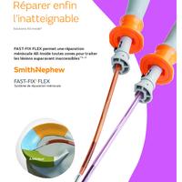FAST-FIX FLEX Brochure.pdf