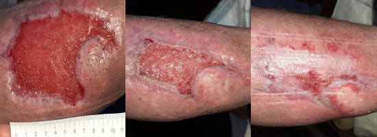 20250321_PICONHW_CaseStudy_b