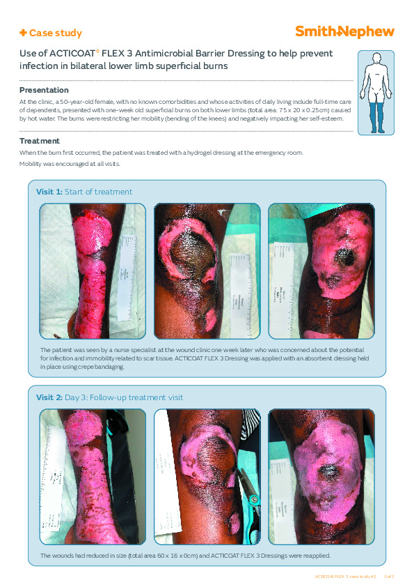 SA Amended ACTICOAT_Burn_case_study_1___bilateral_lower_limb_superficial_burns_0523_pdf_1100950.pdf