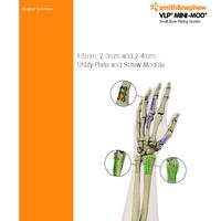 VLP MINI MOD Hand and Wrist Plates Surgical Technique