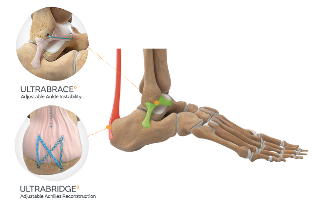 Foot Ankle Overview ANZ