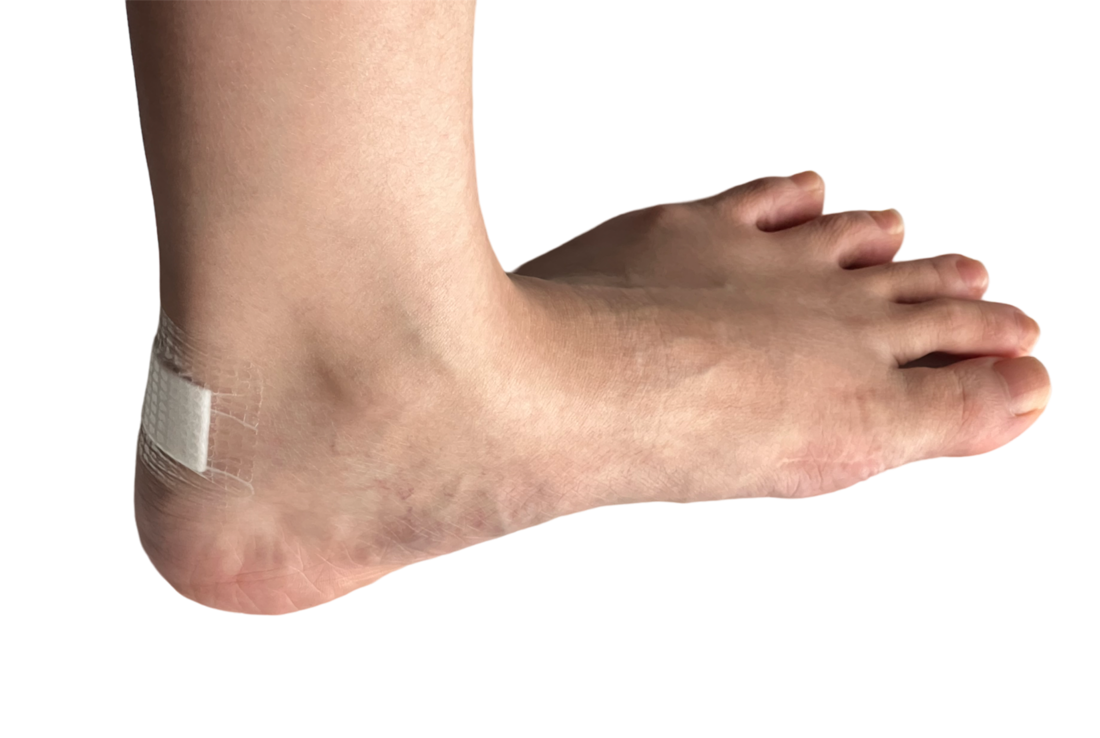 AWM_Shoe blister with OPO.jpg