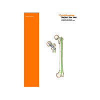 TRIGEN TAN-FAN Surgical Technique